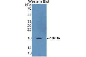Image no. 1 for anti-Relaxin/insulin-Like Family Peptide Receptor 1 (RXFP1) (AA 110-259) antibody (ABIN1860477)