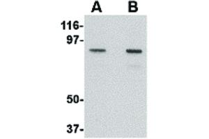 Image no. 2 for anti-Nucleoporin 107kDa (NUP107) (C-Term) antibody (ABIN6657366)