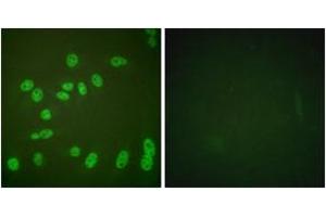 Immunofluorescence analysis of HeLa cells treated with PMA 125ng/ml 30', using POLR2A (Phospho-Ser1619) Antibody.