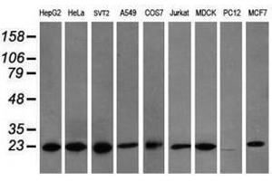 Image no. 6 for anti-Prefoldin Subunit 3 (PFDN3) antibody (ABIN1501707)
