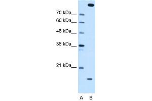 Image no. 1 for anti-Melanoma Inhibitory Activity Protein 2 (MIA2) (Middle Region) antibody (ABIN2783185)