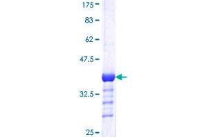 Damage Specific DNA Binding Protein 1 (DDB1) (AA 1044-1140) protein (GST tag)