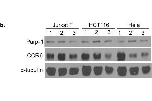 CCR6 expression in human cells treated with 3-aminobenzamide.