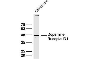 Image no. 4 for anti-Dopamine Receptor D1 (DRD1) (AA 101-200) antibody (ABIN730843)