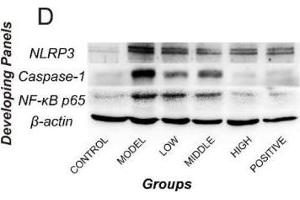 Image no. 30 for anti-Actin, beta (ACTB) (AA 1-50) antibody (ABIN724340)