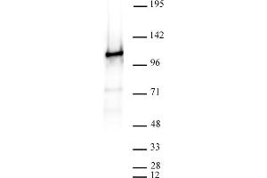 Image no. 3 for anti-CCCTC-Binding Factor (Zinc Finger Protein) (CTCF) antibody (ABIN6971554)