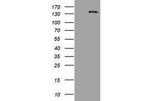 Image no. 2 for anti-Histone Deacetylase 6 (HDAC6) antibody (ABIN2722516)