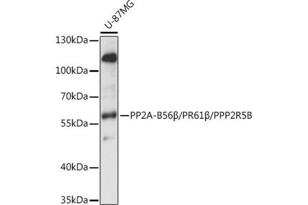 PPP2R5B anticorps  (AA 1-130)