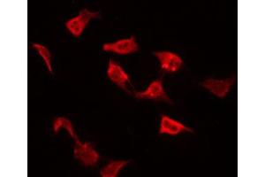 Image no. 2 for anti-Fms-Related tyrosine Kinase 3 (FLT3) (pTyr591) antibody (ABIN6271470)