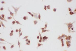 Image no. 1 for anti-Heat Shock Protein 90kDa alpha (Cytosolic), Class A Member 1 (HSP90AA1) (AA 2-365) antibody (ABIN3043847)