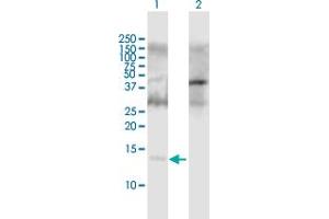 Image no. 1 for anti-Apolipoprotein C-II (APOC2) (AA 1-101) antibody (ABIN1774795)