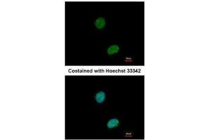 ICC/IF Image Immunofluorescence analysis of paraformaldehyde-fixed HeLa, using Ataxin 3, antibody at 1:500 dilution.