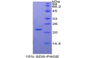 Image no. 1 for TAF12 RNA Polymerase II, TATA Box Binding Protein (TBP)-Associated Factor, 20kDa (TAF12) (AA 1-161) protein (His tag) (ABIN1879709)