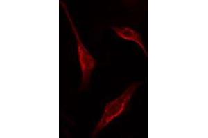 Image no. 1 for anti-Pinin, Desmosome Associated Protein (PNN) (Internal Region) antibody (ABIN6257423)