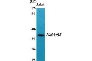 Image no. 2 for anti-Apoptotic Peptidase Activating Factor 1 (APAF1) (C-Term) antibody (ABIN3180484)