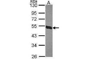 Image no. 2 for anti-Kruppel-Like Factor 5 (Intestinal) (KLF5) (Center) antibody (ABIN2855604)