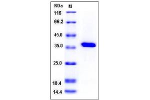 Image no. 1 for Protein tyrosine Phosphatase, Non-Receptor Type 1 (PTPN1) (AA 2-321) (Active) protein (His tag) (ABIN2002547)
