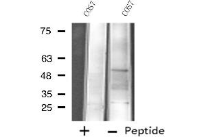 Image no. 1 for anti-Cytochrome P450, Family 4, Subfamily X, Polypeptide 1 (CYP4X1) antibody (ABIN6258079)