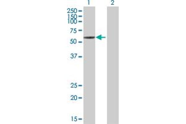 anti-Bestrophin 1 (BEST1) (AA 1-604) antibody