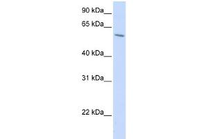Image no. 1 for anti-Porcupine Homolog (PORCN) (N-Term) antibody (ABIN2783888)