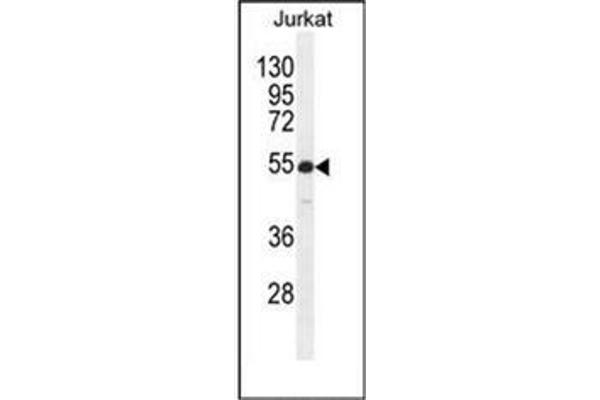 RBPJL Antikörper  (N-Term)