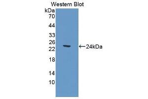 Image no. 1 for anti-Carnosine Dipeptidase 1 (Metallopeptidase M20 Family) (CNDP1) (AA 332-507) antibody (ABIN1867282)