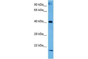 Image no. 2 for anti-NF-kappa-B inhibitor beta (NFKBIB) (Middle Region) antibody (ABIN2775761)