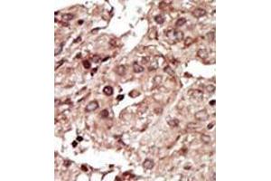 Image no. 1 for anti-phosphorylase Kinase, gamma 1 (Muscle) (PHKG1) (Middle Region) antibody (ABIN359431)