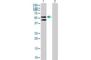 Image no. 1 for anti-Carboxypeptidase M (CPM) (AA 1-443) antibody (ABIN514566)