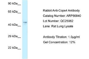 Image no. 1 for anti-COP9 Signalosome Subunit 4 (COPS4) (N-Term) antibody (ABIN2786931)