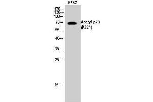 Image no. 1 for anti-Tumor Protein P73 (TP73) (acLys321) antibody (ABIN3181893)