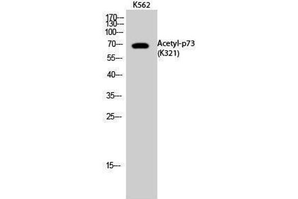 Tumor Protein p73 Antikörper  (acLys321)