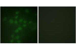 Immunofluorescence analysis of HuvEc cells, using Telomerase (Phospho-Ser227) Antibody.