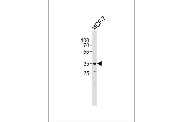anti-F-Box and Leucine-Rich Repeat Protein 17 (FBXL17) (AA 262-297), (C-Term), (Isoform 2) antibody