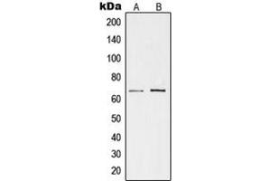 Image no. 1 for anti-Testis-Specific Kinase 1 (TESK1) (Center) antibody (ABIN2707163)