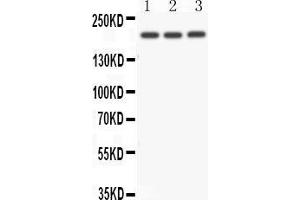 Image no. 1 for anti-Notch 4 (NOTCH4) (AA 1805-1818), (C-Term) antibody (ABIN3043028)