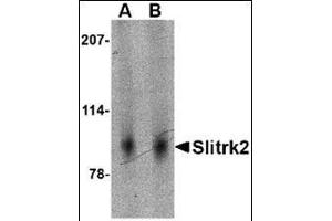 Image no. 2 for anti-SLIT and NTRK-Like Family, Member 2 (SLITRK2) (Middle Region) antibody (ABIN500756)