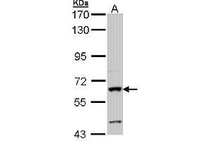 Image no. 2 for anti-Alkaline Phosphatase (ALP) (Center) antibody (ABIN2856846)