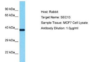 Image no. 1 for anti-SEC13 Homolog (SEC13) (Middle Region) antibody (ABIN2792059)