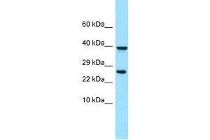 Image no. 1 for anti-Platelet-Derived Growth Factor Receptor-Like (PDGFRL) (N-Term) antibody (ABIN2790370)