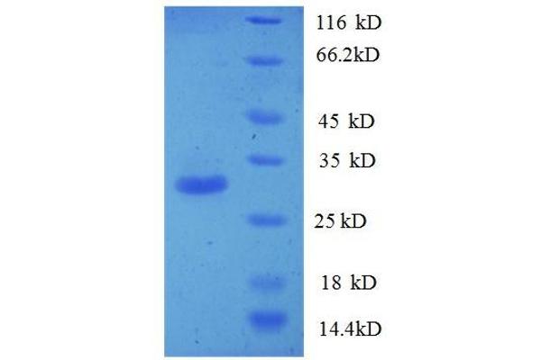 PTDSS1 Protein (AA 1-35, partial) (GST tag)