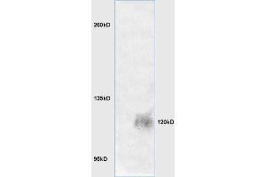 Image no. 1 for anti-Leucine-Rich Repeats and Immunoglobulin-Like Domains 1 (Lrig1) (AA 1001-1093) antibody (ABIN735263)
