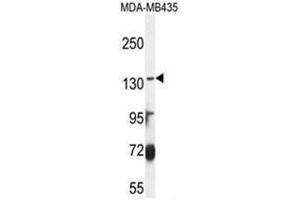 Image no. 3 for anti-ATP-Binding Cassette, Sub-Family C (CFTR/MRP), Member 3 (ABCC3) (AA 906-933), (Middle Region) antibody (ABIN950200)