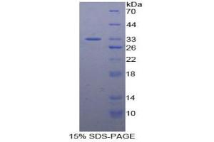 Image no. 1 for N-Methylpurine-DNA Glycosylase (MPG) protein (ABIN3010961)