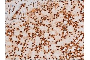 Image no. 10 for anti-REL proto-oncogene (c-Rel) (pSer503) antibody (ABIN6255382)