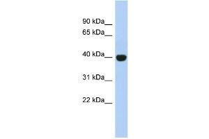 Image no. 1 for anti-KIAA1191 (KIAA1191) (Middle Region) antibody (ABIN2786624)