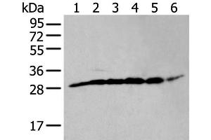 Western blot analysis of PC-3 cell mouse skeletal muscle tissue mouse brain tissue human heart tissue Hela and HEPG2 cell lysates using ETFB Polyclonal Antibody at dilution of 1:400