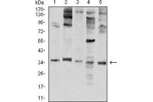 Image no. 4 for anti-Elastase, Neutrophil Expressed (ELANE) (AA 140-267) antibody (ABIN5611332)