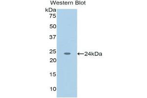 Image no. 1 for anti-Tumor Necrosis Factor (Ligand) Superfamily, Member 12 (TNFSF12) (AA 65-247) antibody (ABIN1176219)