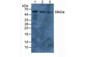 Image no. 6 for Pyruvate Kinase M2 (PKM2) ELISA Kit (ABIN6574169)